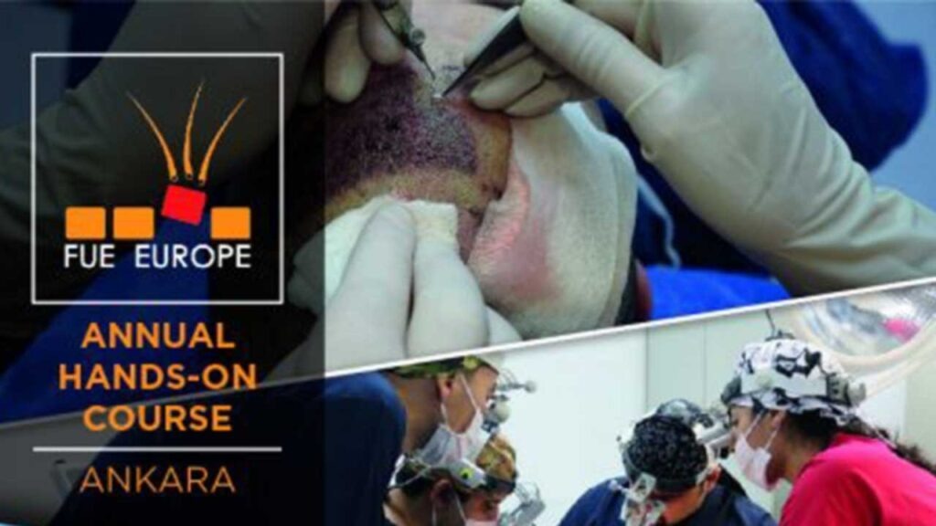 Hands-on FUE hair transplant training course at HTTC Ankara